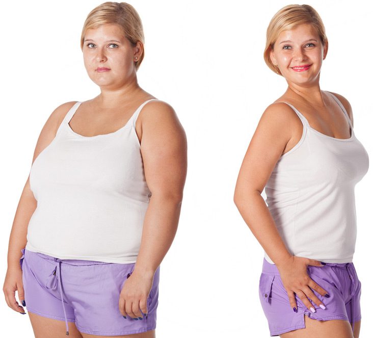 Woman-posing-before-and-after-weight-loss
