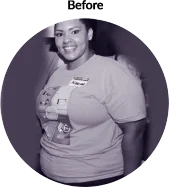 nikesha_before - Weight Loss Surgery - Orange County, CA