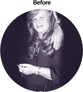 donna_before - Weight Loss Surgery - Orange County, CA