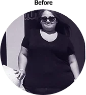 lavina_before - Weight Loss Surgery - Orange County, CA