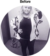 ashley_before - Weight Loss Surgery - Orange County, CA